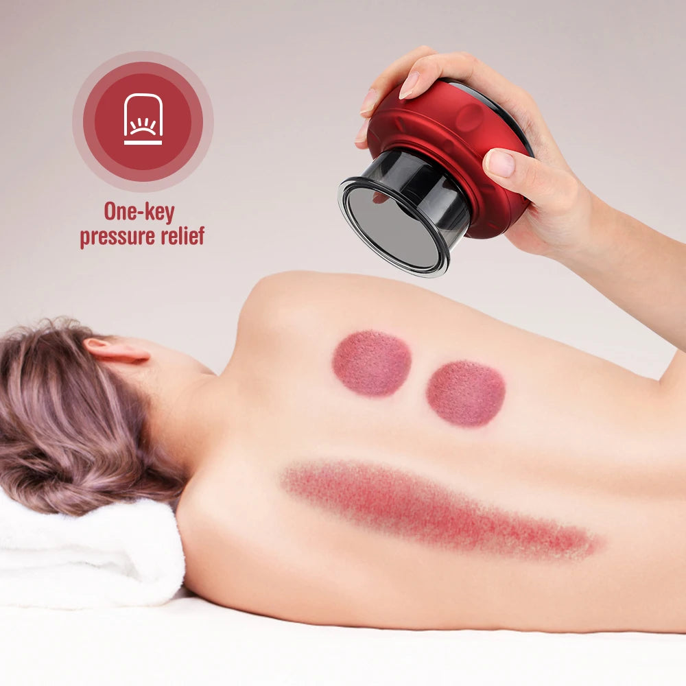 Electric Cupping Therapy Device: Vacuum Suction, Heating, Guasha - Relieve Muscle Fatigue & Pain