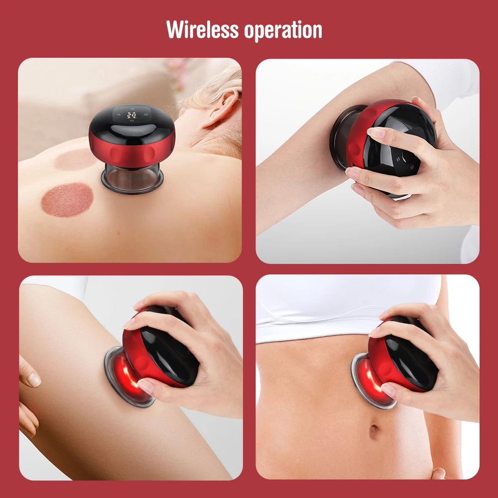 Electric Cupping Therapy Device: Vacuum Suction, Heating, Guasha - Relieve Muscle Fatigue & Pain